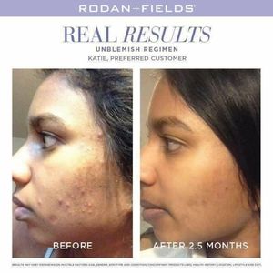 Unblemish Set - NEW